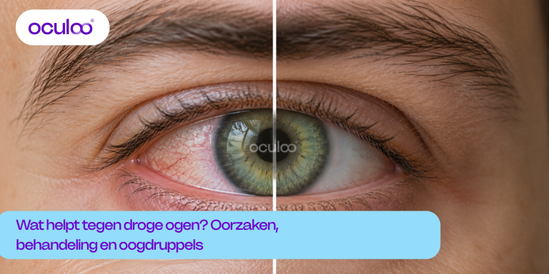 Groen oog met links zichtbare roodheid door droge ogen en rechts een rustiger oog