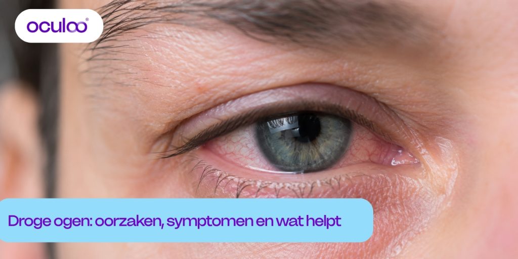 Droge ogen met roodheid en irritatie als veelvoorkomende symptomen